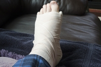 Things to Know About a Broken Foot