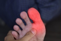 Underlying Factors of Swollen Toes