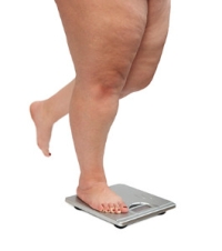 The Feet May Be Affected by Obesity